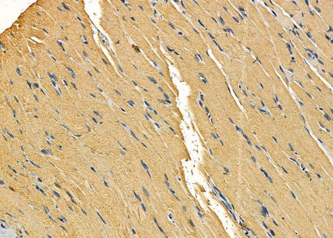 alpha Actinin 3 Antibody in Immunohistochemistry (Paraffin) (IHC (P))