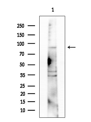 alpha Actinin 3 Antibody in Western Blot (WB)