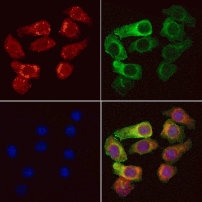 UBA52 Antibody in Immunocytochemistry (ICC/IF)