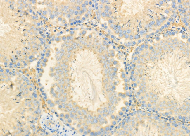 CEACAM6 Antibody in Immunohistochemistry (Paraffin) (IHC (P))