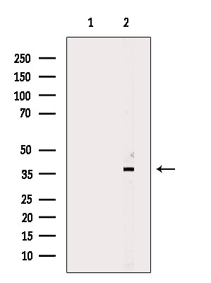 CEACAM6 Antibody in Western Blot (WB)