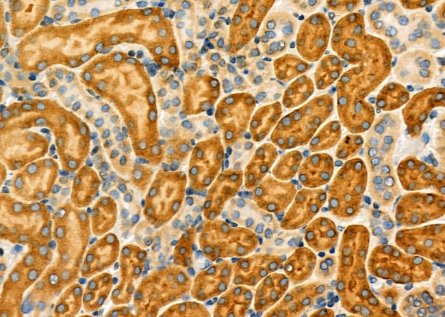 Ly-6A Antibody in Immunohistochemistry (Paraffin) (IHC (P))