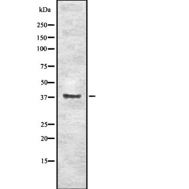 EN1 Antibody in Western Blot (WB)