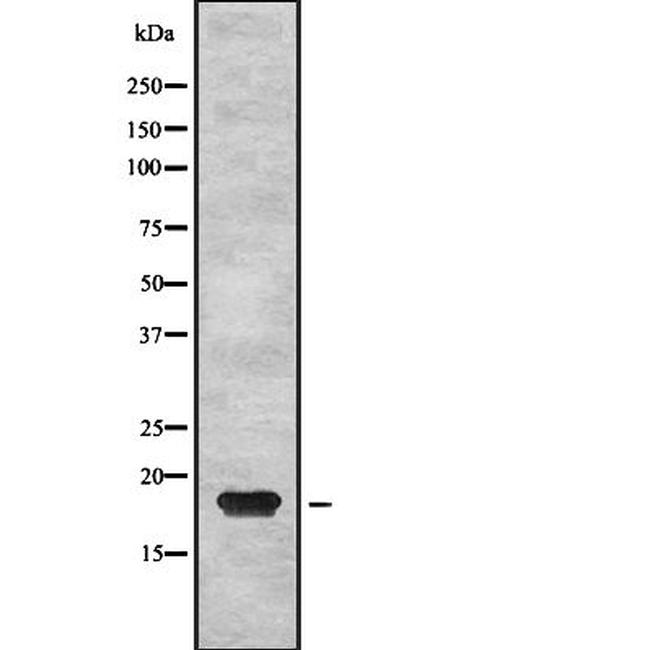 PTP4A2 Antibody in Western Blot (WB)