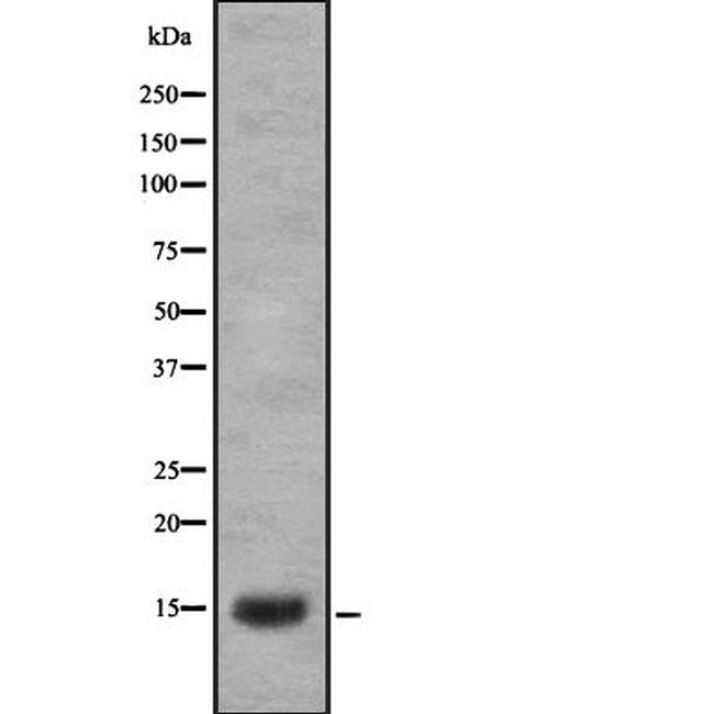 LGALS1 Antibody in Western Blot (WB)