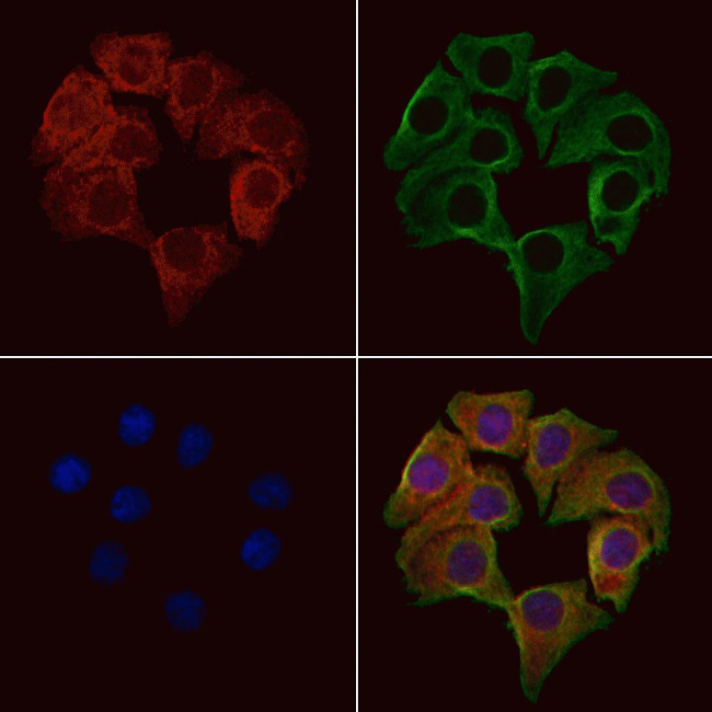 CD3g Antibody in Immunocytochemistry (ICC/IF)