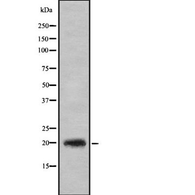 CD3g Antibody in Western Blot (WB)