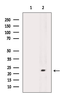 CLEC3B Antibody in Western Blot (WB)
