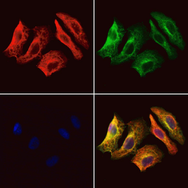 Kir2.1 (KCNJ2) Antibody in Immunocytochemistry (ICC/IF)