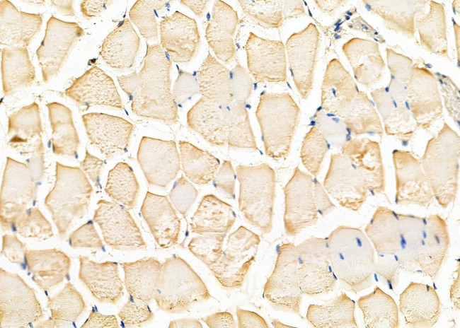 FDFT1 Antibody in Immunohistochemistry (Paraffin) (IHC (P))