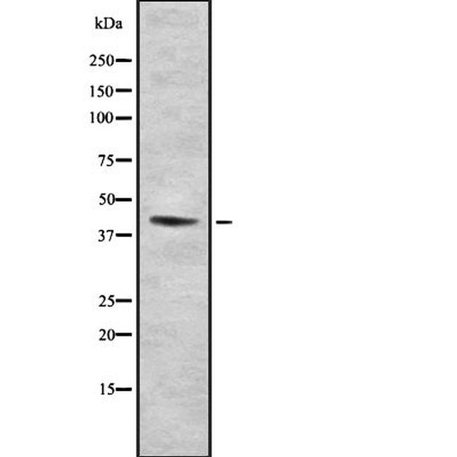 FNTA Antibody in Western Blot (WB)