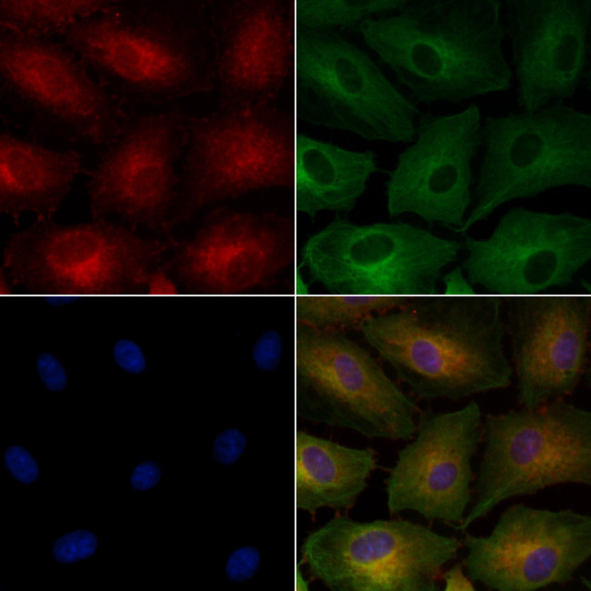 Renalase Antibody in Immunocytochemistry (ICC/IF)