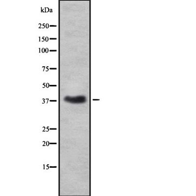 Renalase Antibody in Western Blot (WB)