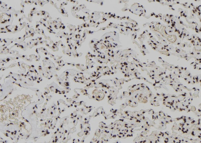 XPO4 Antibody in Immunohistochemistry (Paraffin) (IHC (P))