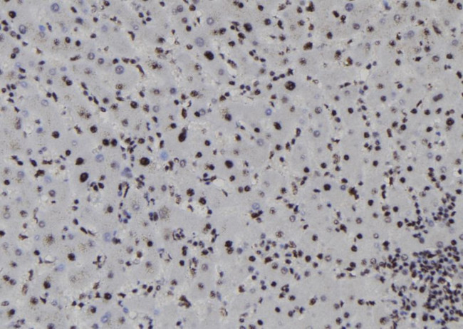 SOX1 Antibody in Immunohistochemistry (Paraffin) (IHC (P))