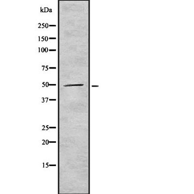 SOX1 Antibody in Western Blot (WB)