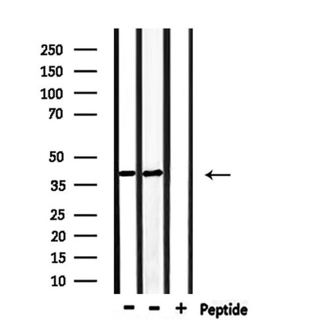 p39 Antibody in Western Blot (WB)