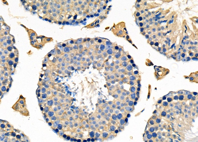 UGGT1 Antibody in Immunohistochemistry (Paraffin) (IHC (P))