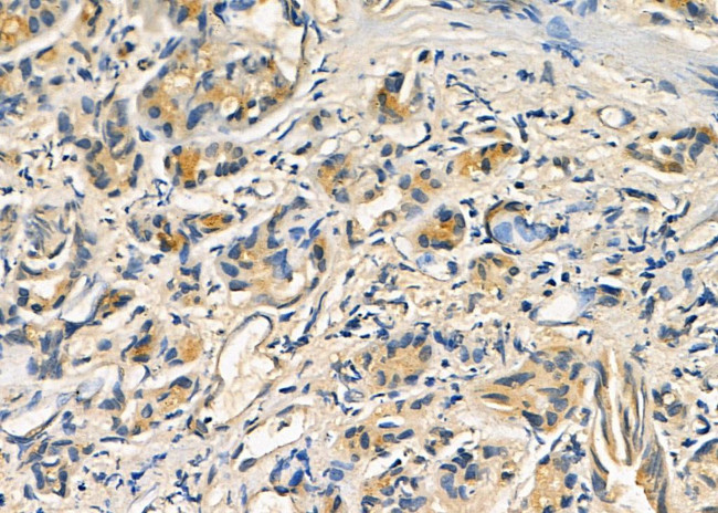 URM1 Antibody in Immunohistochemistry (Paraffin) (IHC (P))