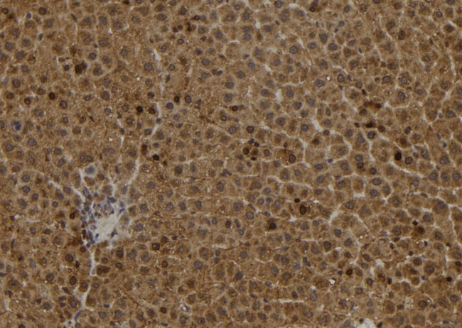 S100A2 Antibody in Immunohistochemistry (Paraffin) (IHC (P))