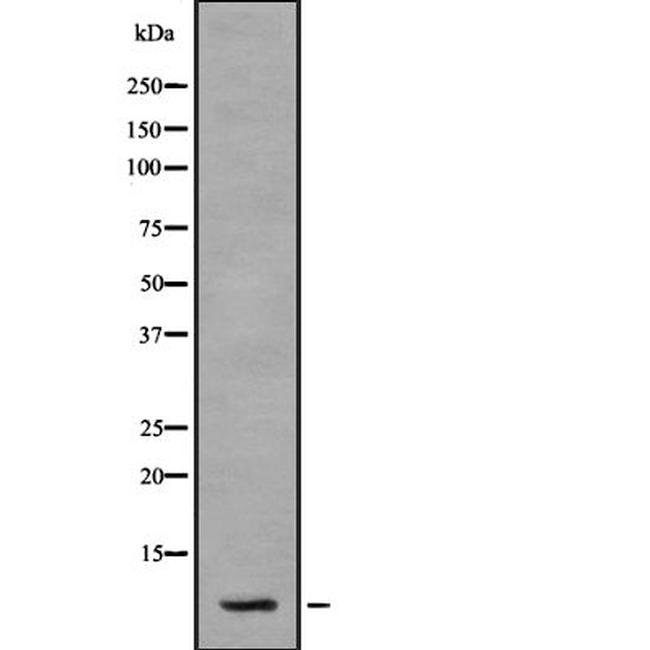 S100A2 Antibody in Western Blot (WB)