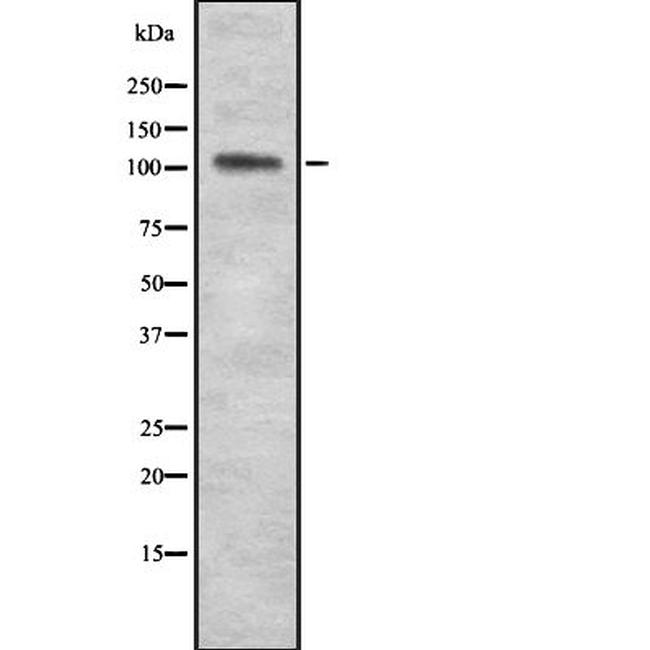 PAM Antibody in Western Blot (WB)