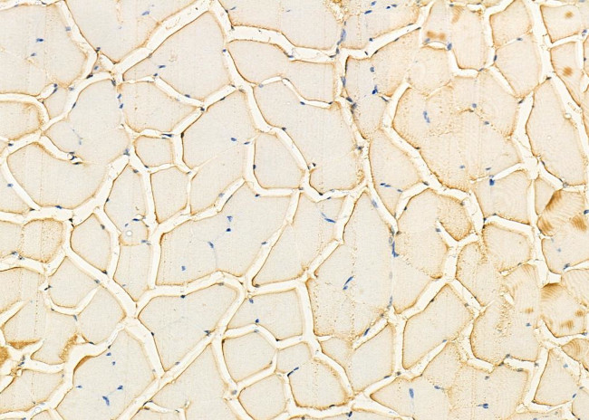 GFPT1 Antibody in Immunohistochemistry (Paraffin) (IHC (P))