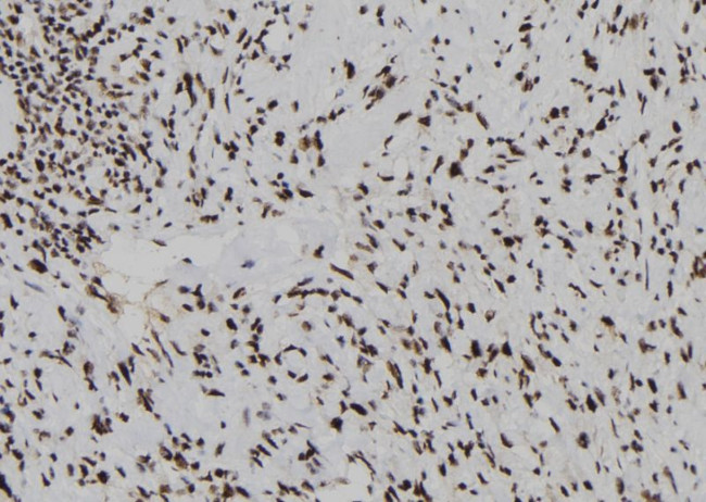 DUSP3 Antibody in Immunohistochemistry (Paraffin) (IHC (P))