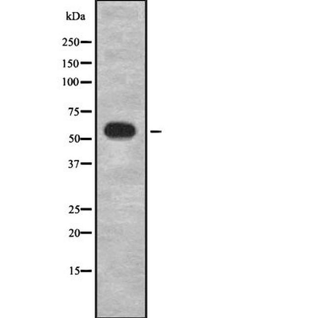 GRK1 Antibody in Western Blot (WB)