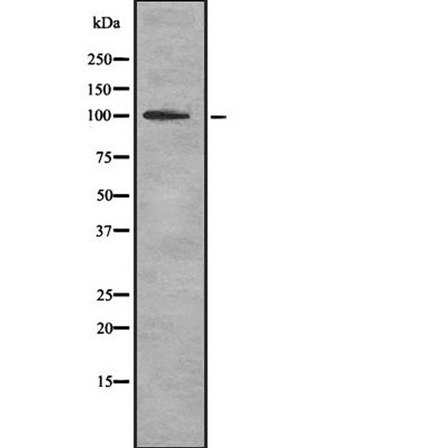 Thyroid Peroxidase Antibody in Western Blot (WB)