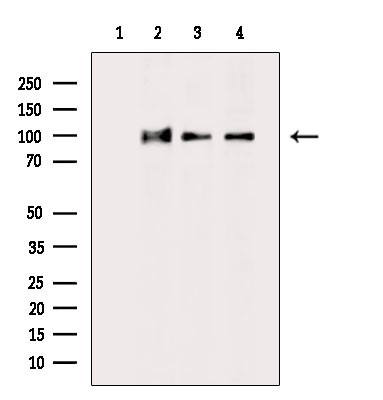 KAP3 Antibody in Western Blot (WB)