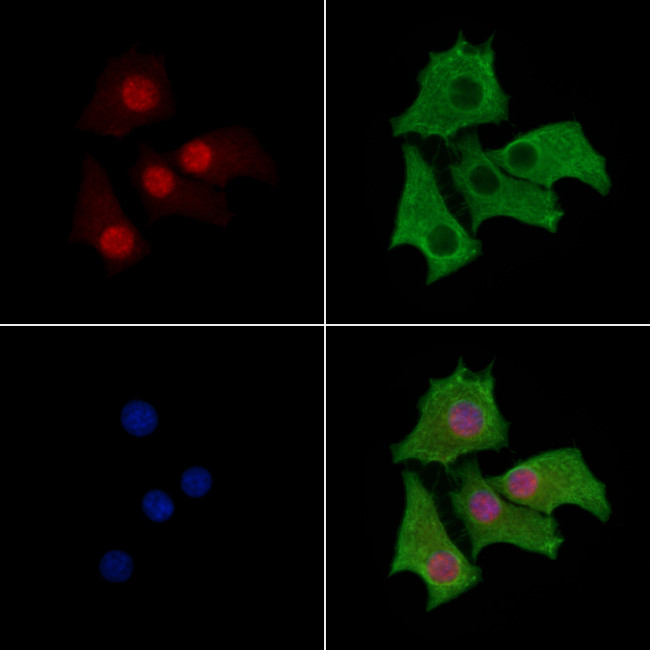 PKP3 Antibody in Immunocytochemistry (ICC/IF)