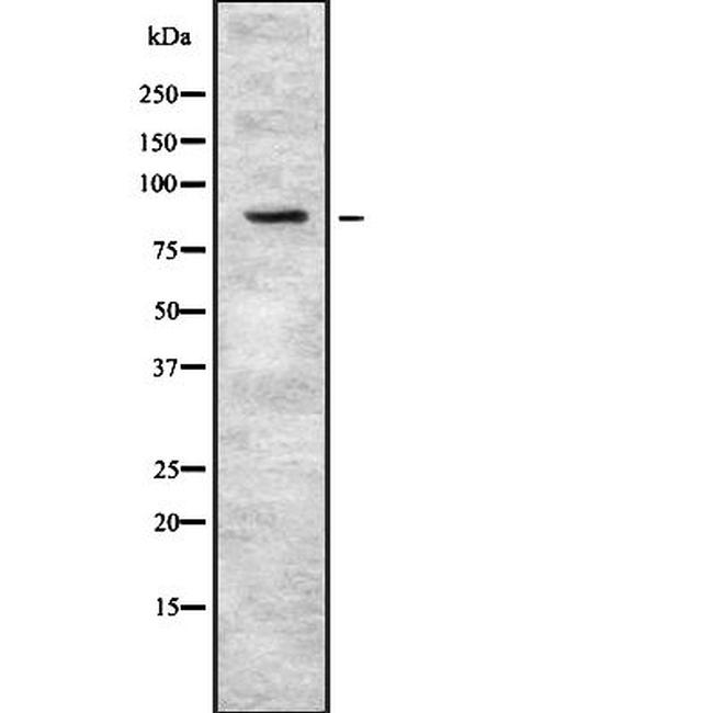 PKP3 Antibody in Western Blot (WB)