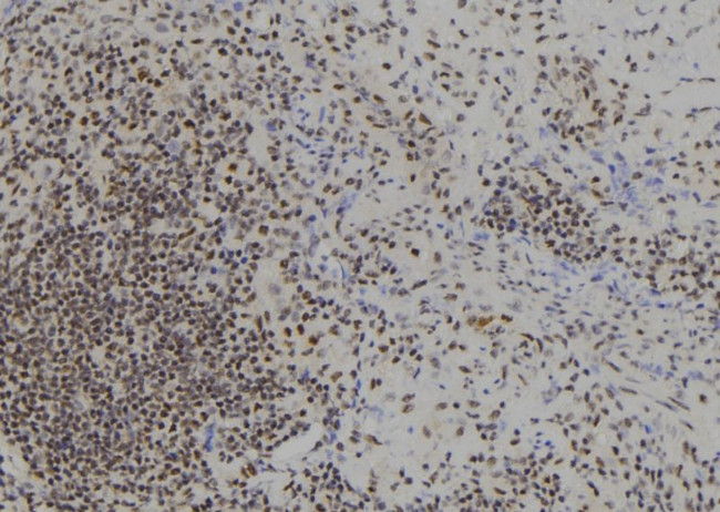 BACH1 Antibody in Immunohistochemistry (Paraffin) (IHC (P))