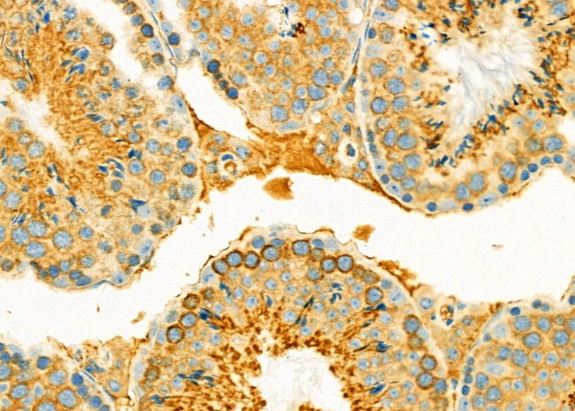 LEFTY2 Antibody in Immunohistochemistry (Paraffin) (IHC (P))