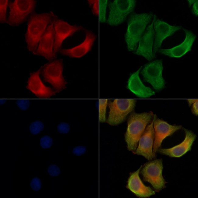 SPTBN1 Antibody in Immunocytochemistry (ICC/IF)