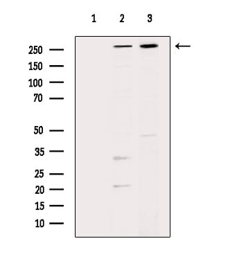 SPTBN1 Antibody in Western Blot (WB)