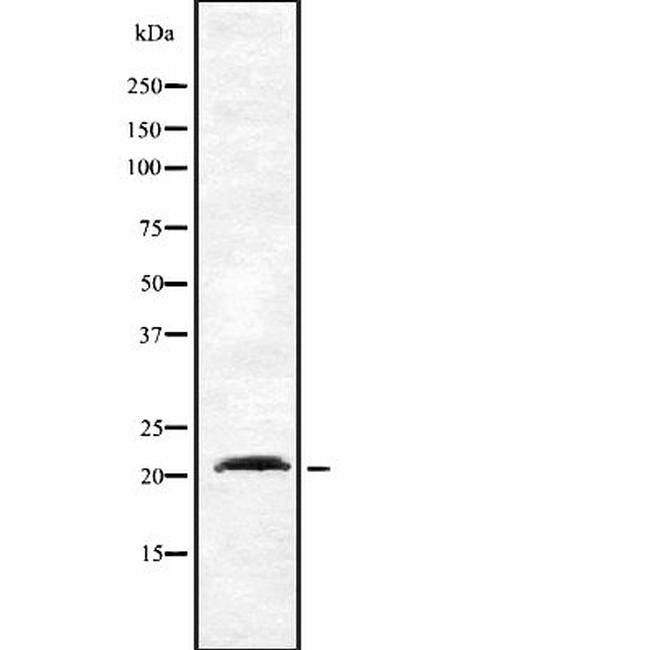 Dynactin 3 Antibody in Western Blot (WB)