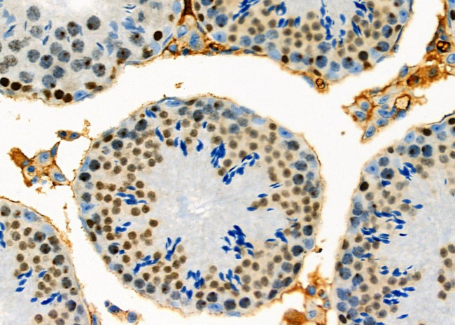 DUX4 Antibody in Immunohistochemistry (Paraffin) (IHC (P))