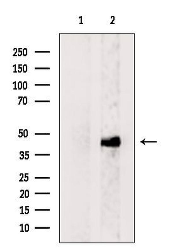 DUX4 Antibody in Western Blot (WB)