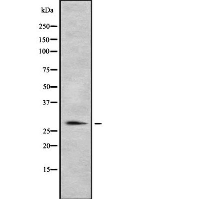 HLA-DR/DP Antibody in Western Blot (WB)