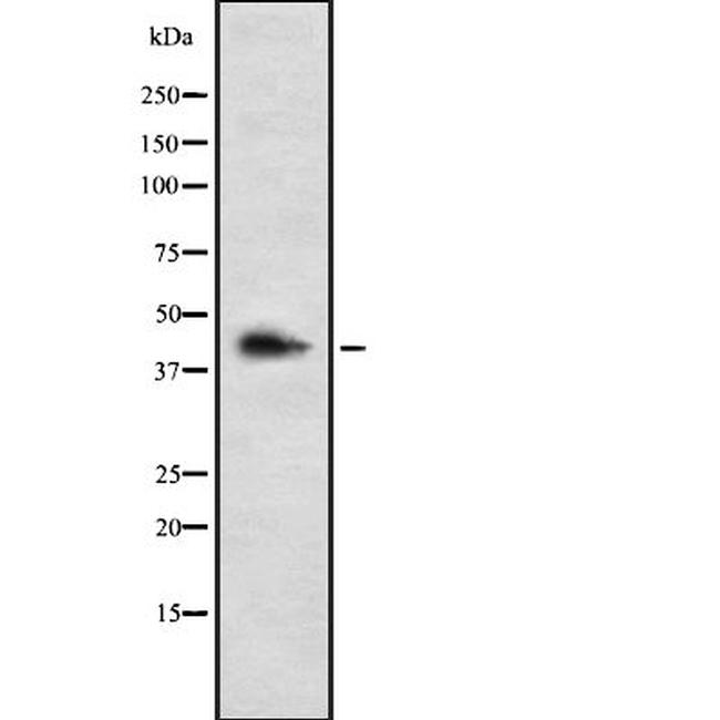 LHX3 Antibody in Western Blot (WB)