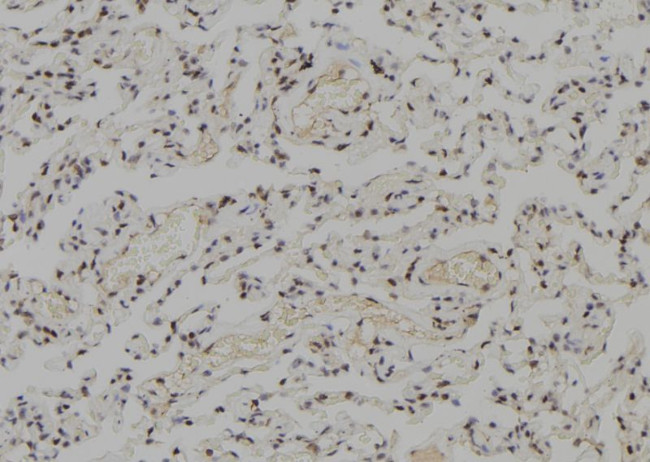 WRN Antibody in Immunohistochemistry (Paraffin) (IHC (P))