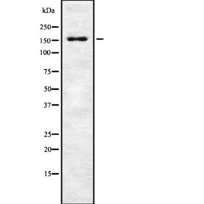 WRN Antibody in Western Blot (WB)