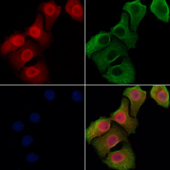 CHD5 Antibody in Immunocytochemistry (ICC/IF)