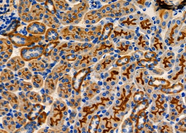 CARD9 Antibody in Immunohistochemistry (Paraffin) (IHC (P))