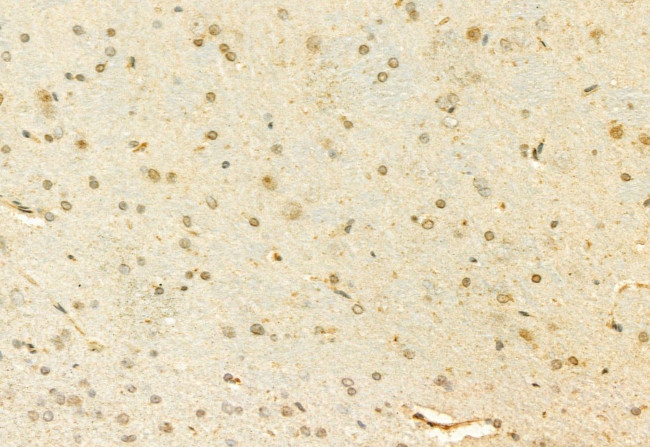 MUC2 Antibody in Immunohistochemistry (Paraffin) (IHC (P))