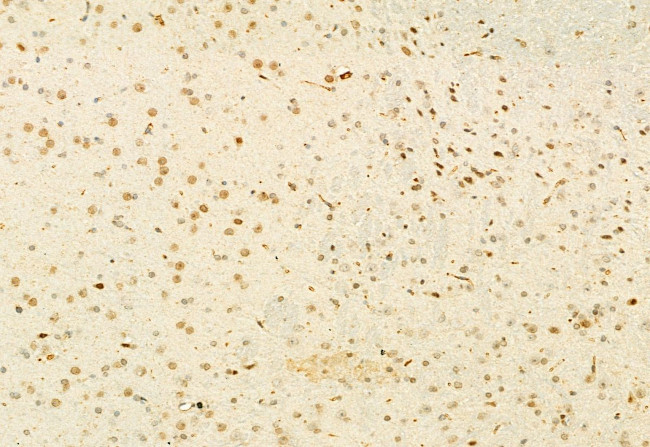 MUC2 Antibody in Immunohistochemistry (Paraffin) (IHC (P))