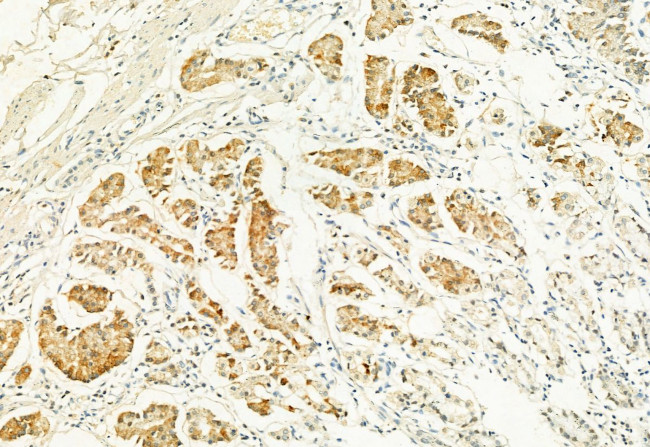 MUC2 Antibody in Immunohistochemistry (Paraffin) (IHC (P))