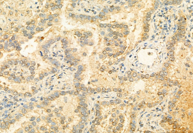 MUC2 Antibody in Immunohistochemistry (Paraffin) (IHC (P))